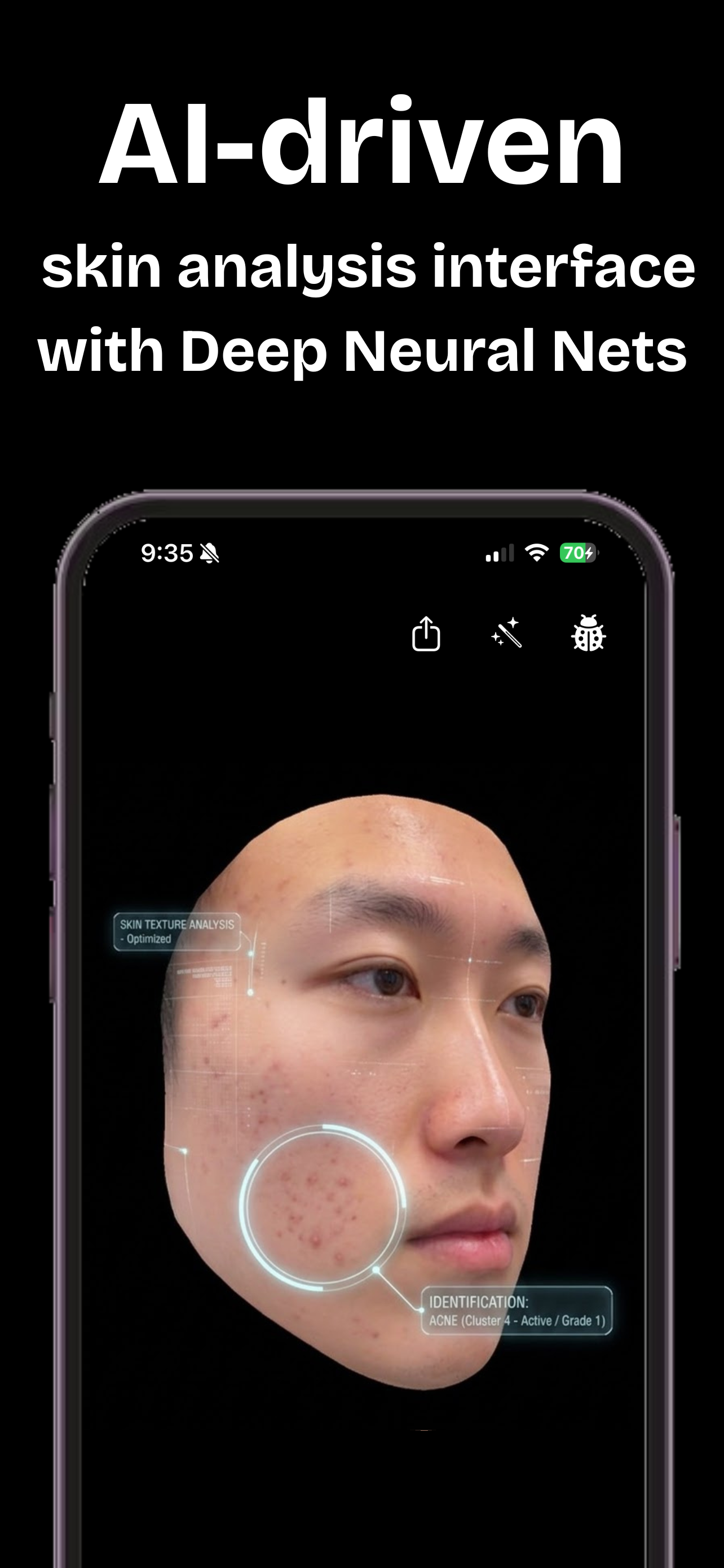 AI-driven skin analysis interface with acne identification